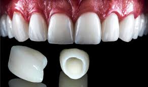 Zirconium Crowns Treatment Services