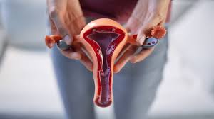 Vaginal Discharge Treatment Services