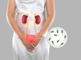 Urinary Tract Infection Treatment Services